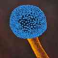 Aspergillus al Microscopio 979/6.jpg
